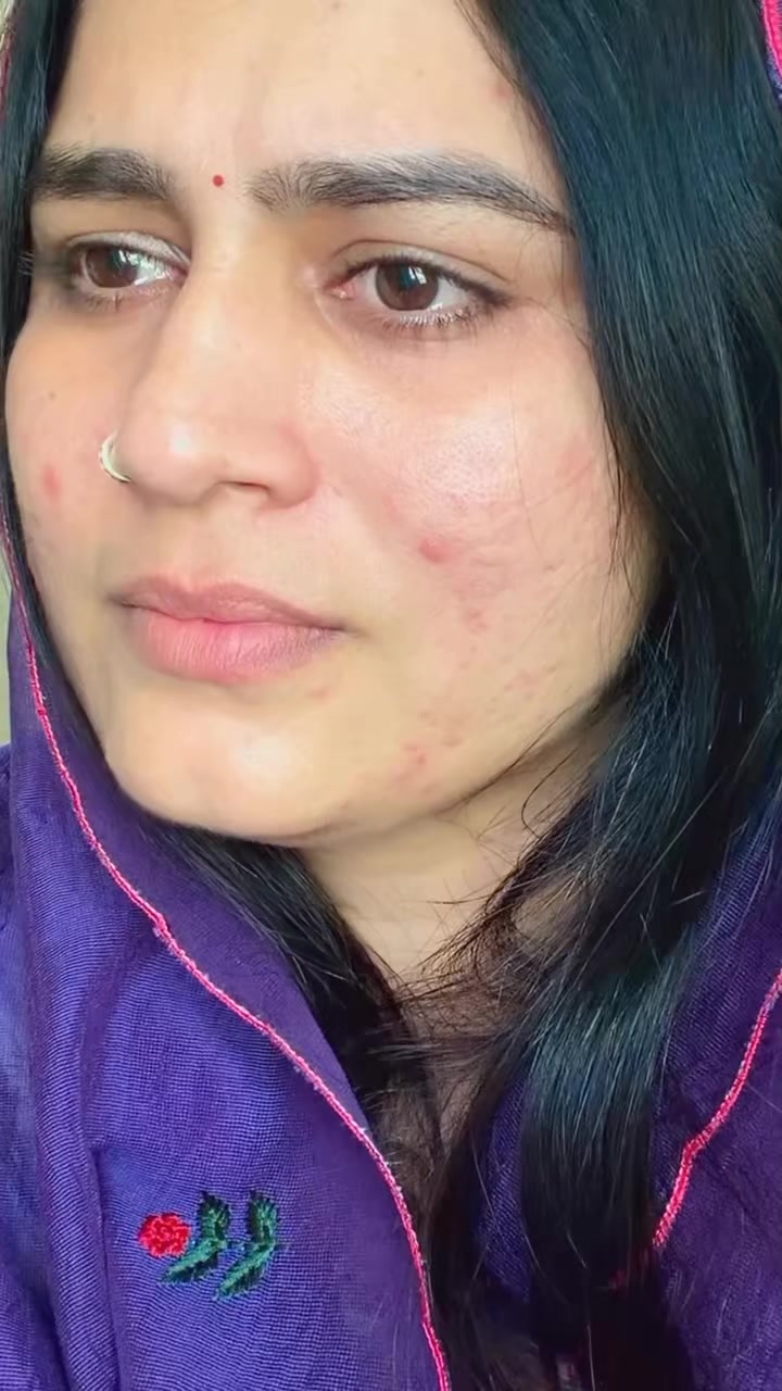 @Shani 2222