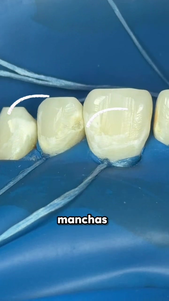 @Cava Clínica Dental 🦷