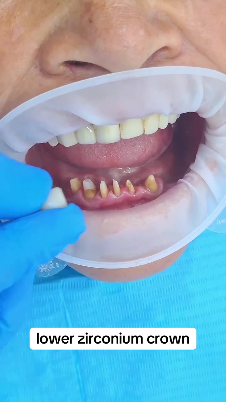 @Aun dental clinic ❤️