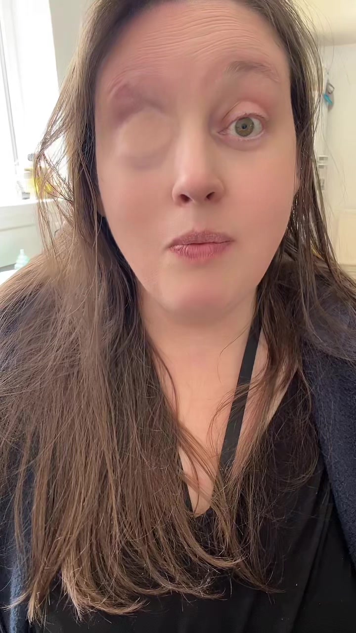 @eyeofthesarcoma