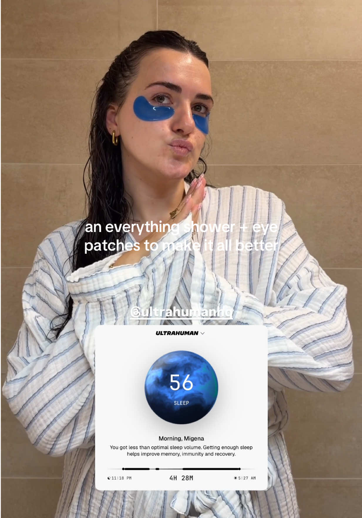 @MIGENA