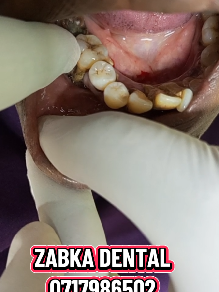 @Zabka Dental