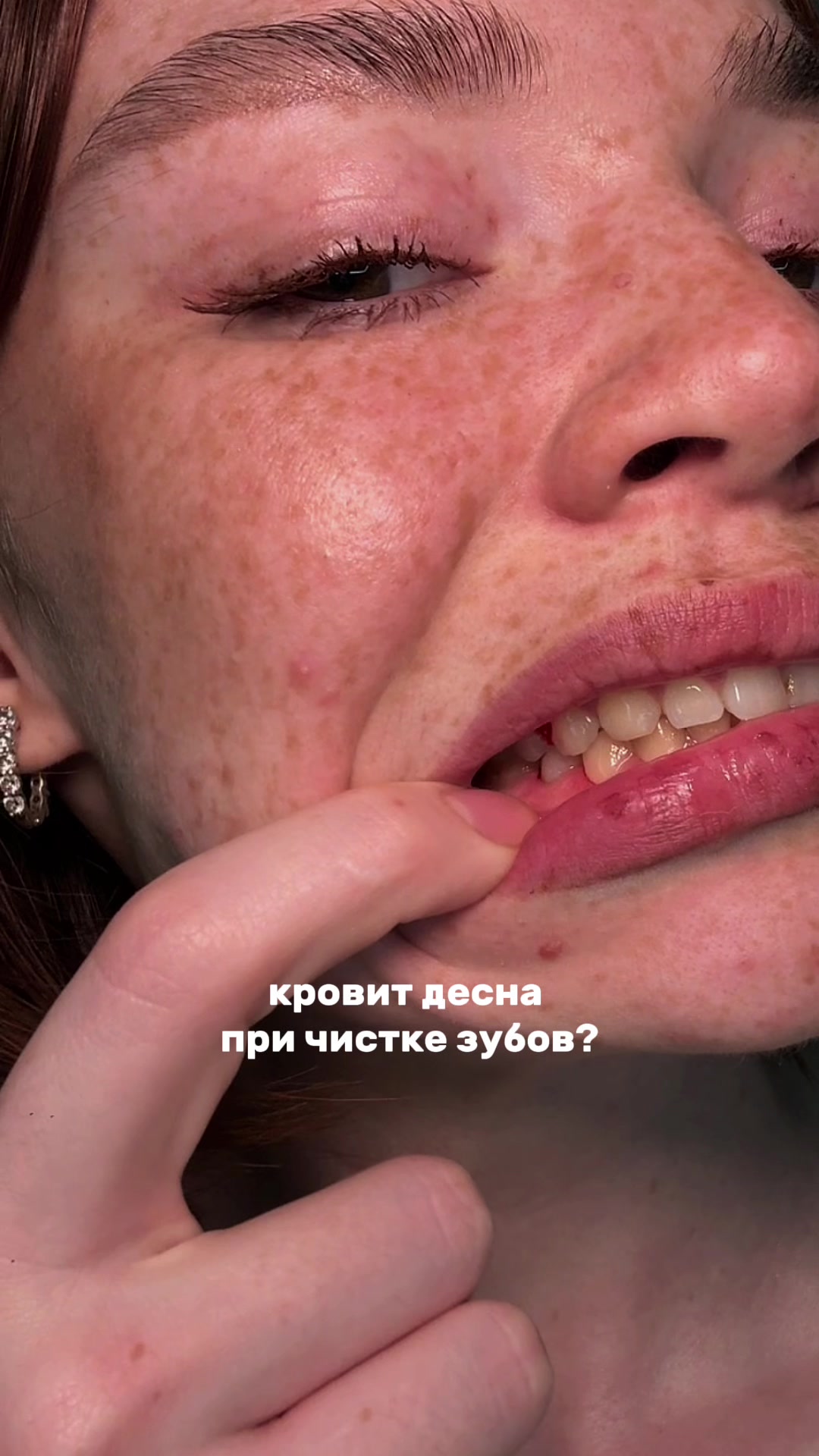 @Стоматологиня