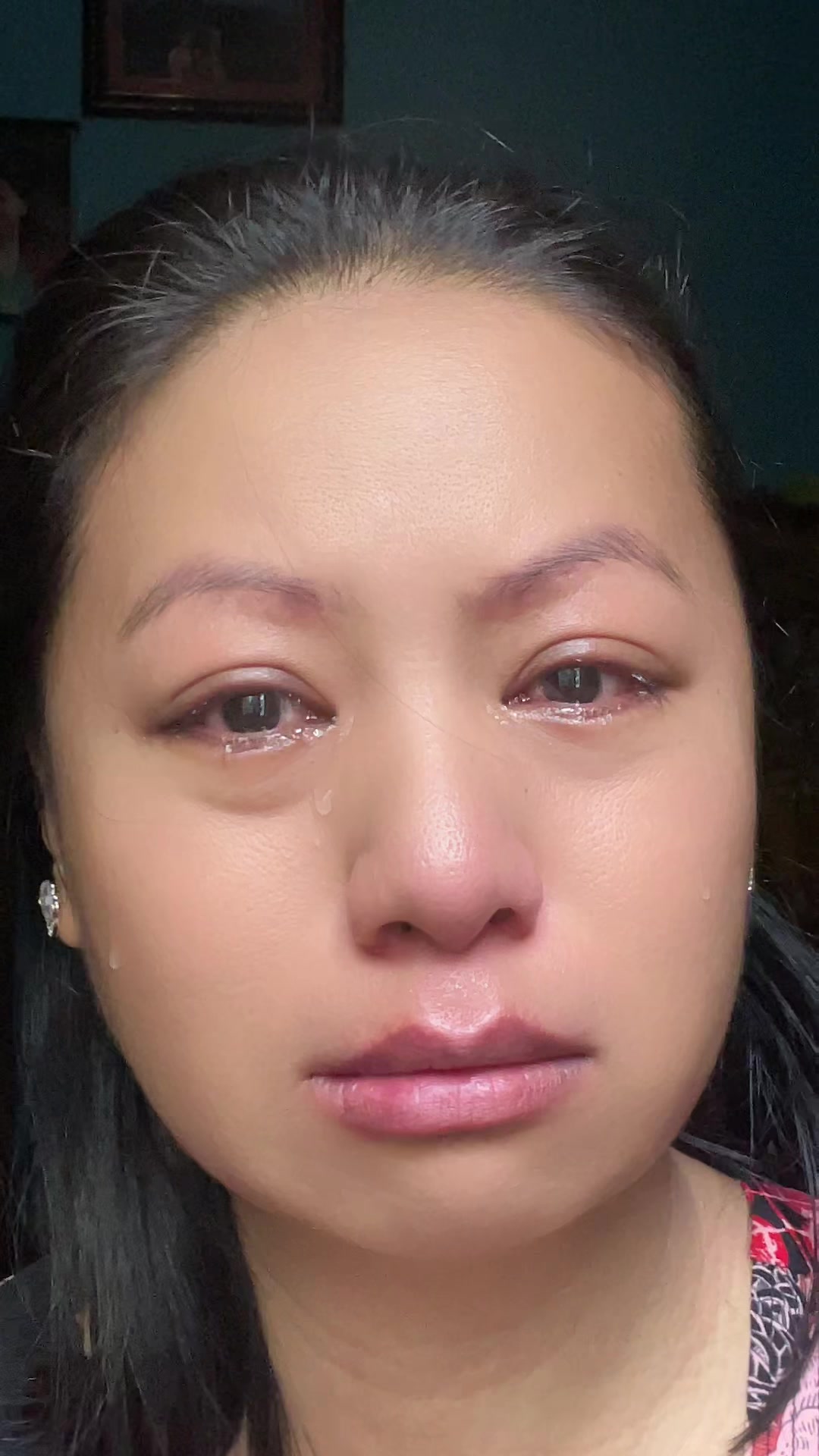 @laxmishrestha438 रून्ची 😭💔