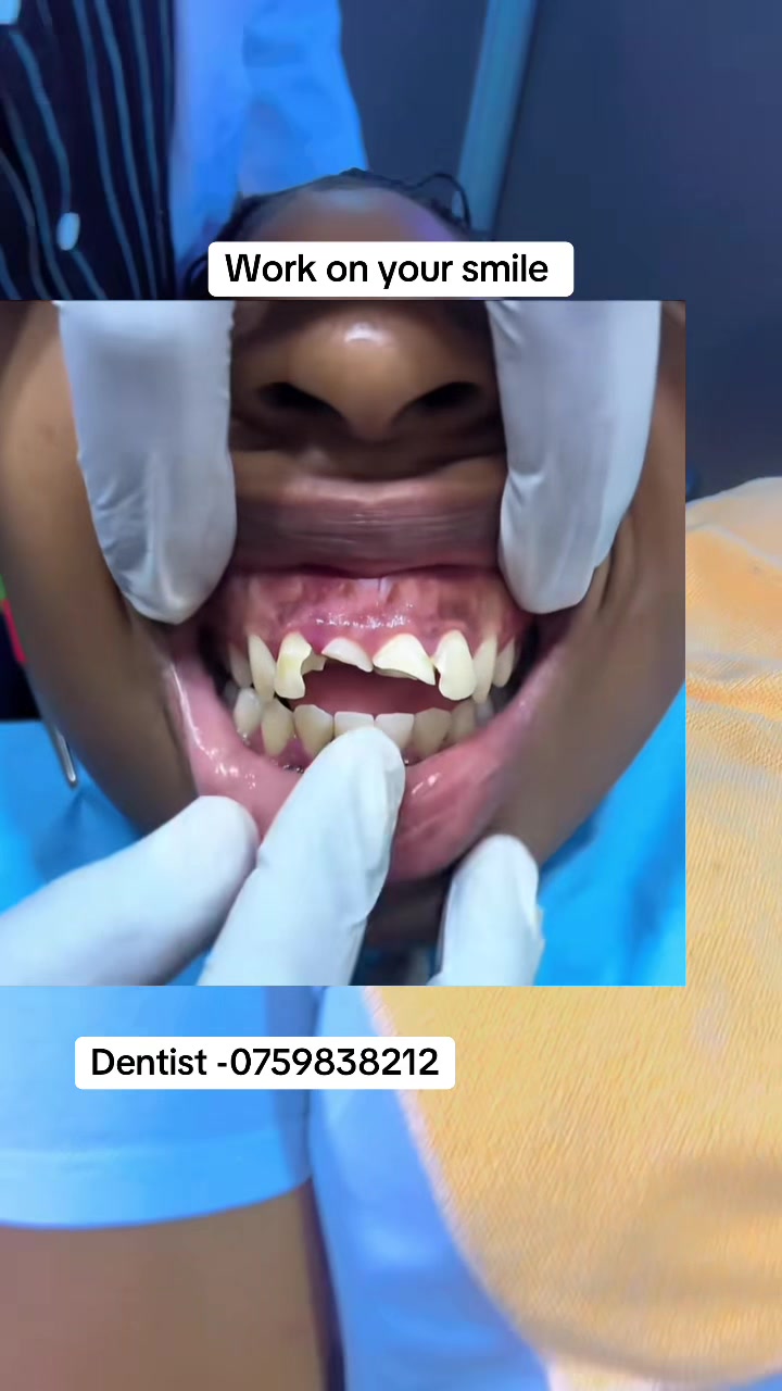 @Dr Sabila🦷🇺🇬🌍