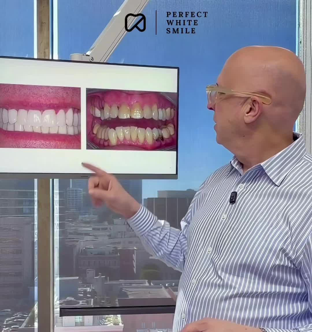 @Perfect White Smile/ Dr. Frey