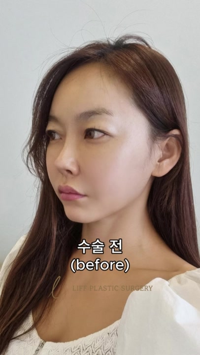 @리프성형외과 김기엽 대표원장