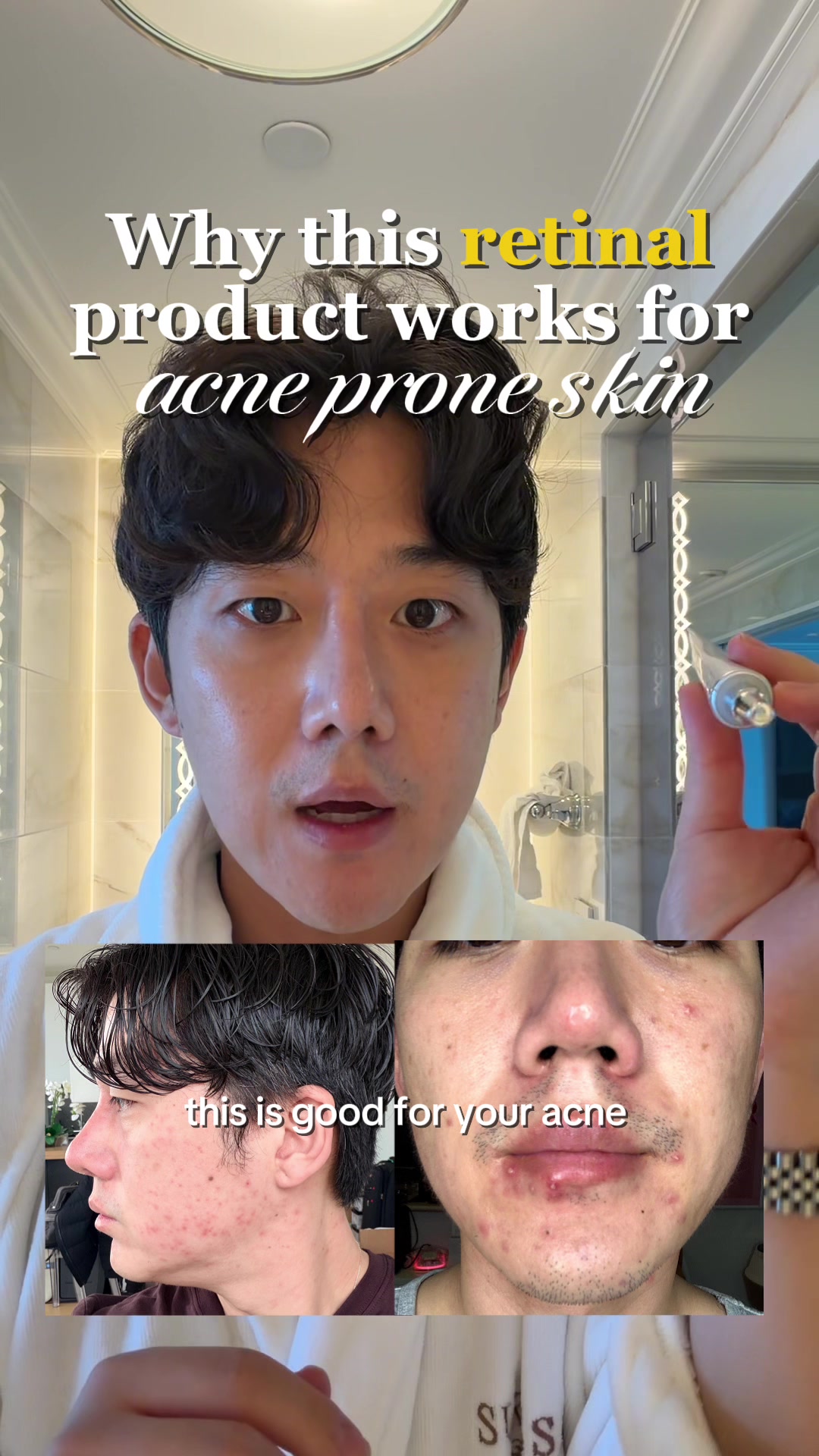 @Brute Choi 🧿