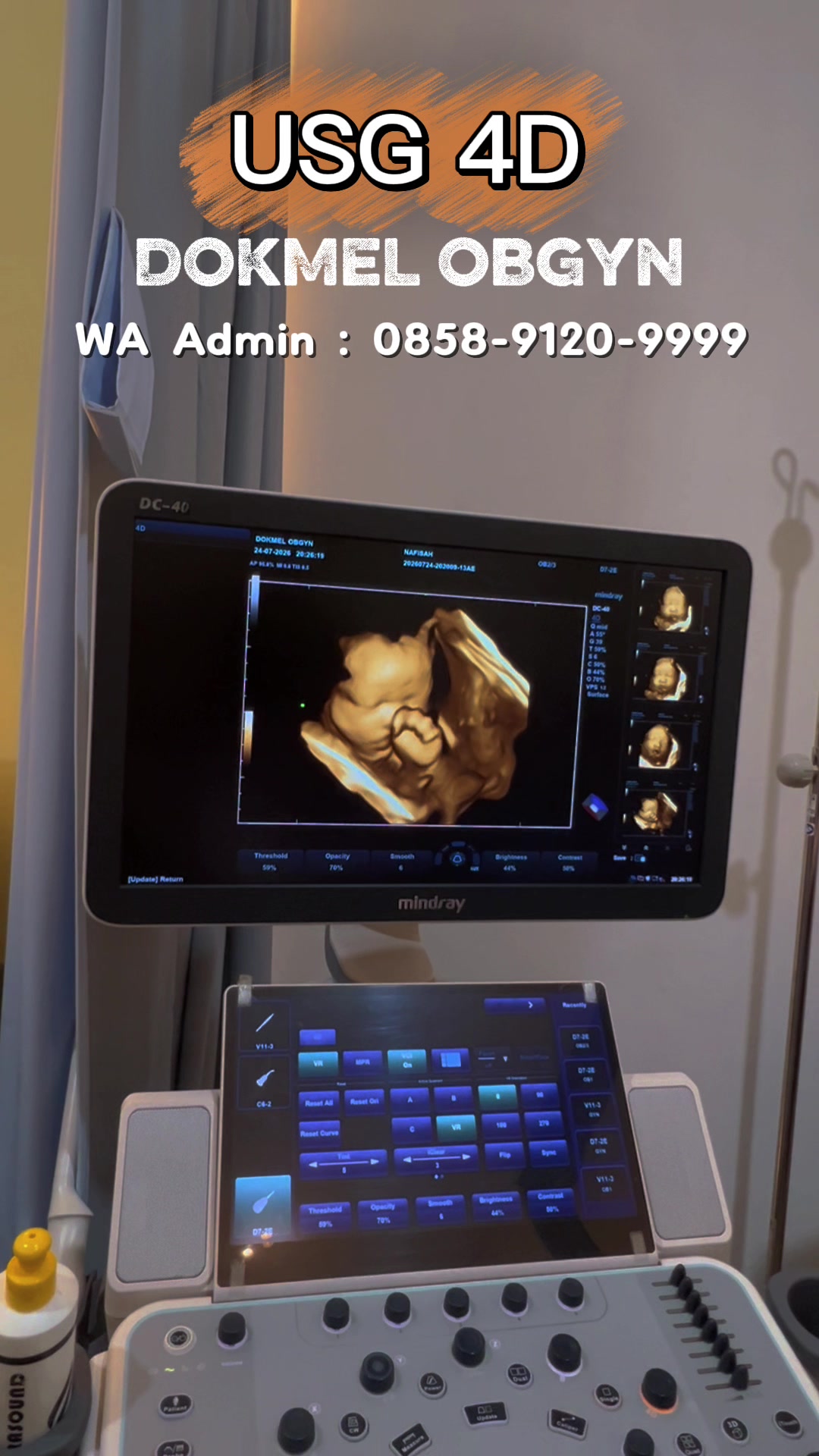 @DokMeL ObGyn