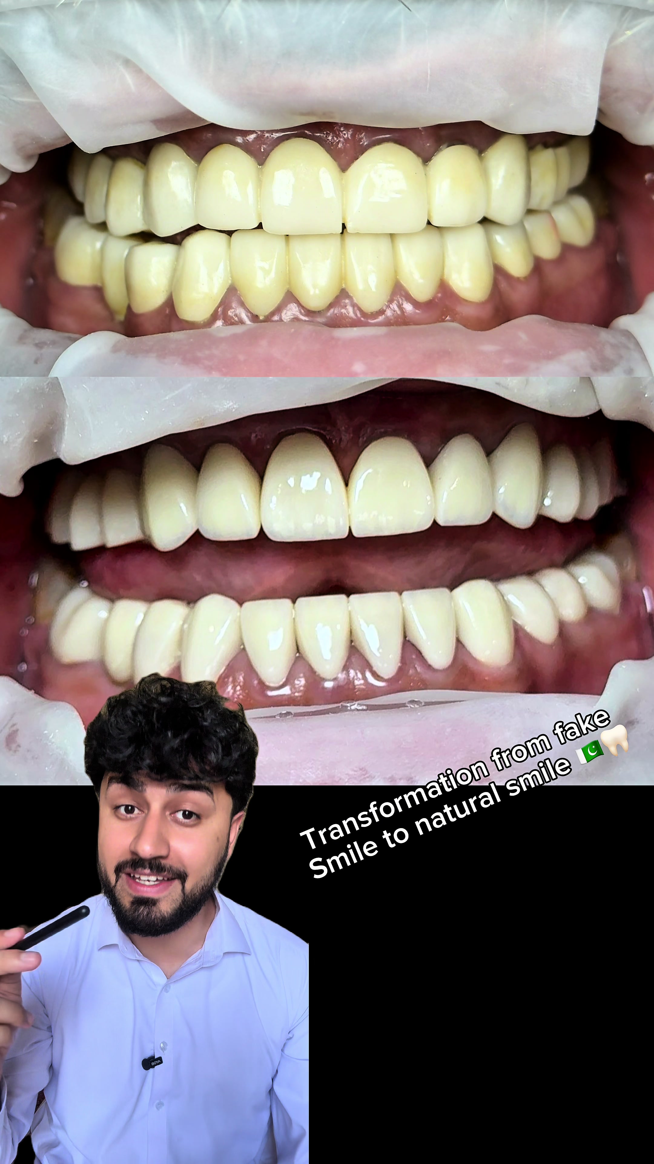 @Dr Haroon Shah