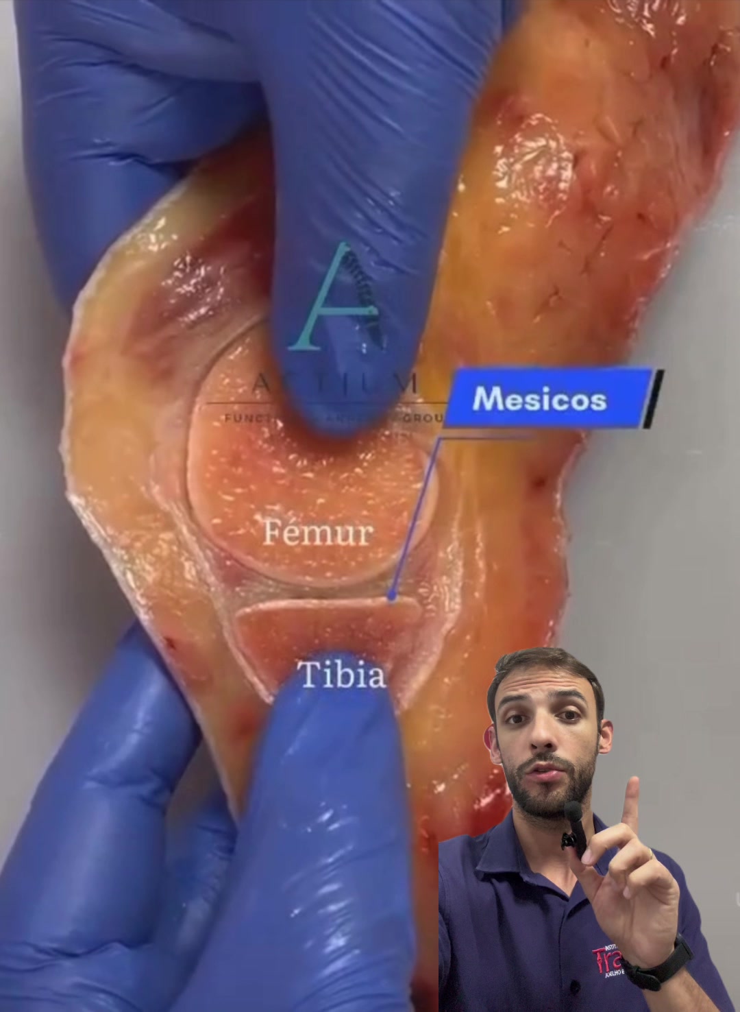 @Vinicius Titico