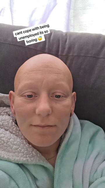 @baldies_adventures