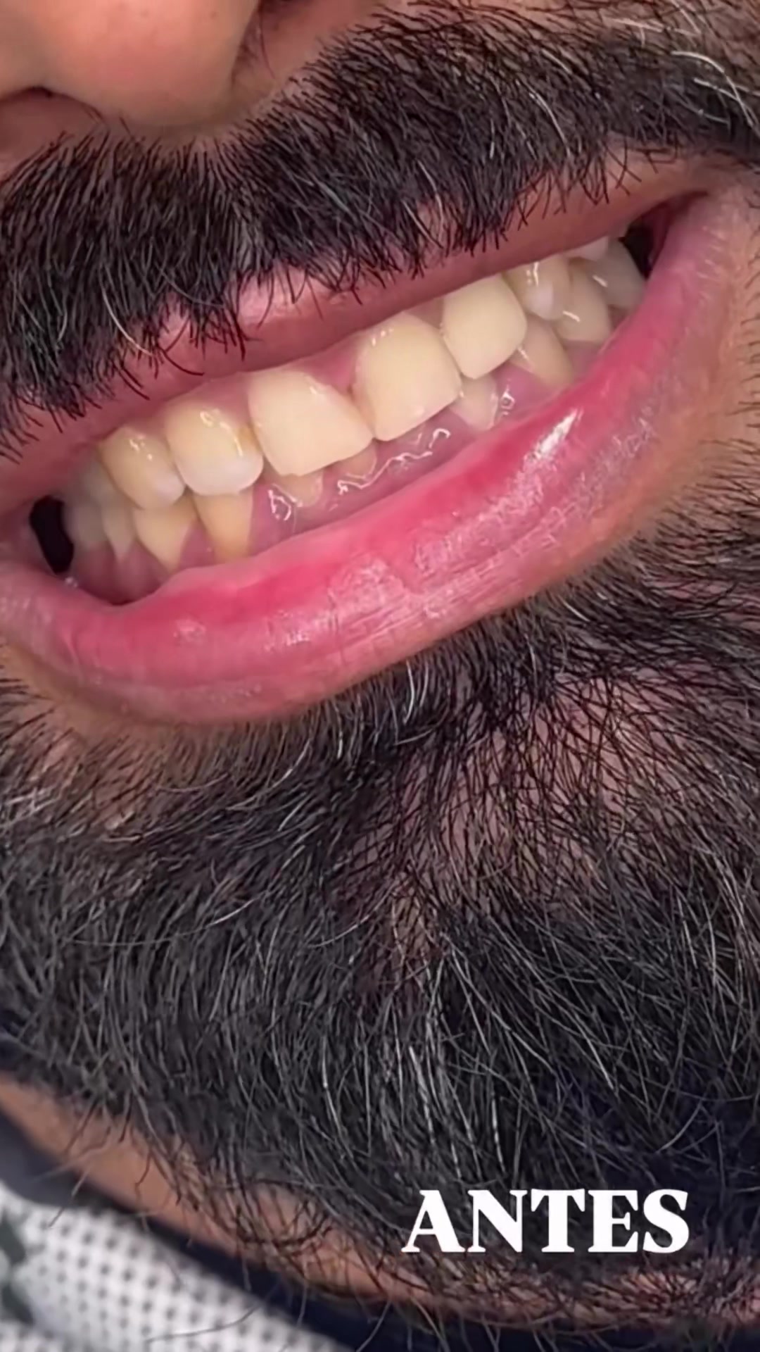 @Artista de sonrisas