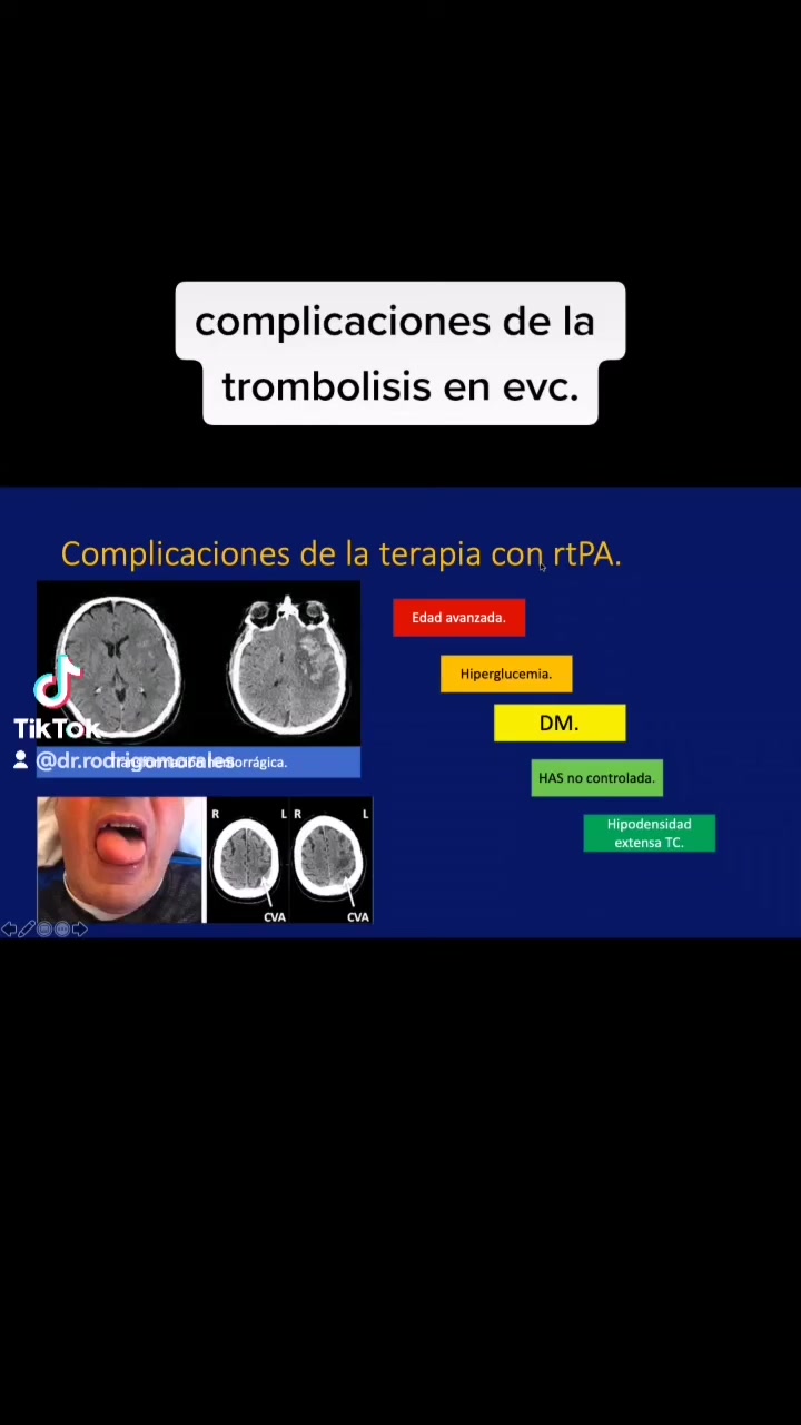 @Dr. Ajolote.