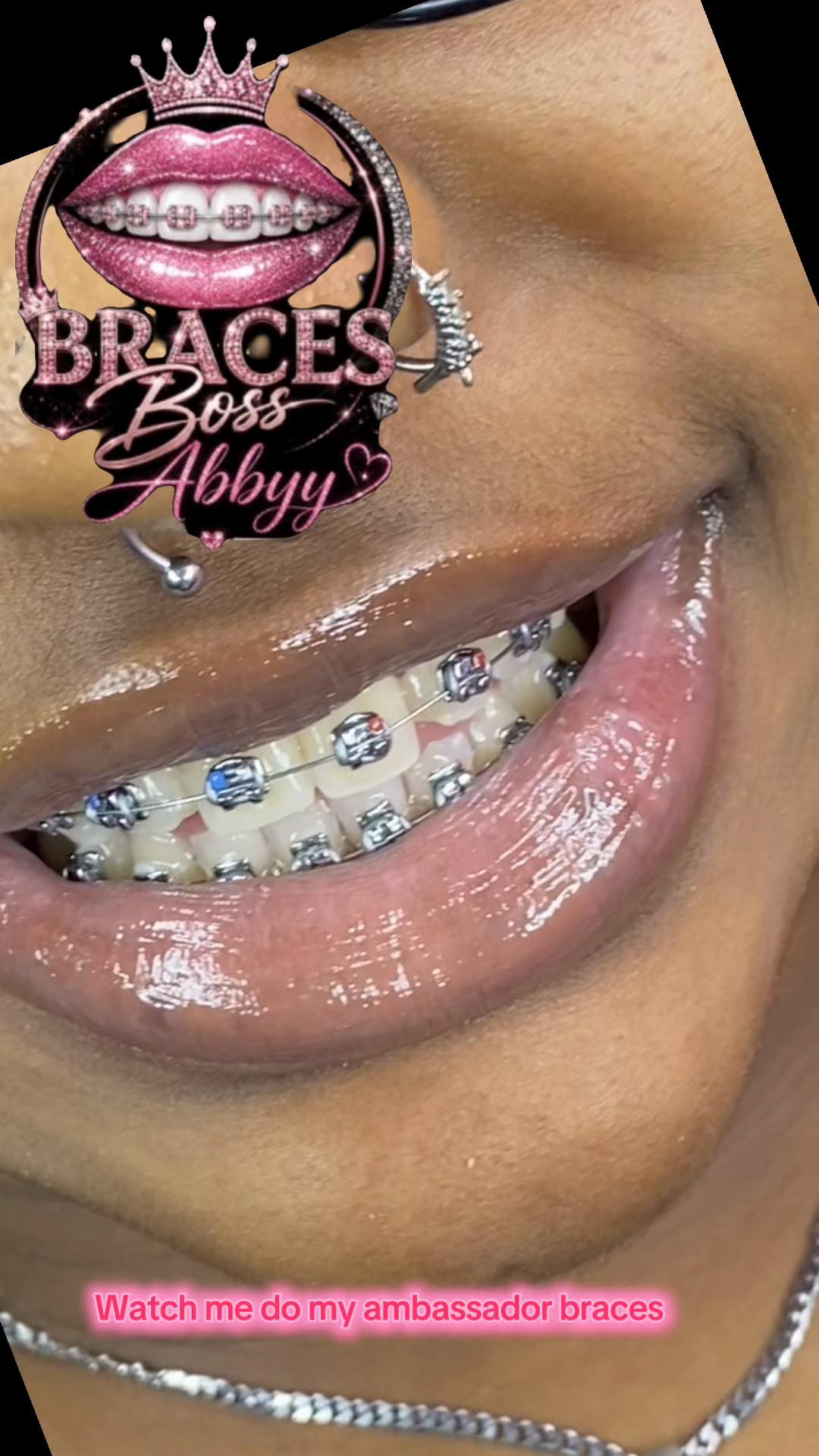 @abbyy_abbyy_