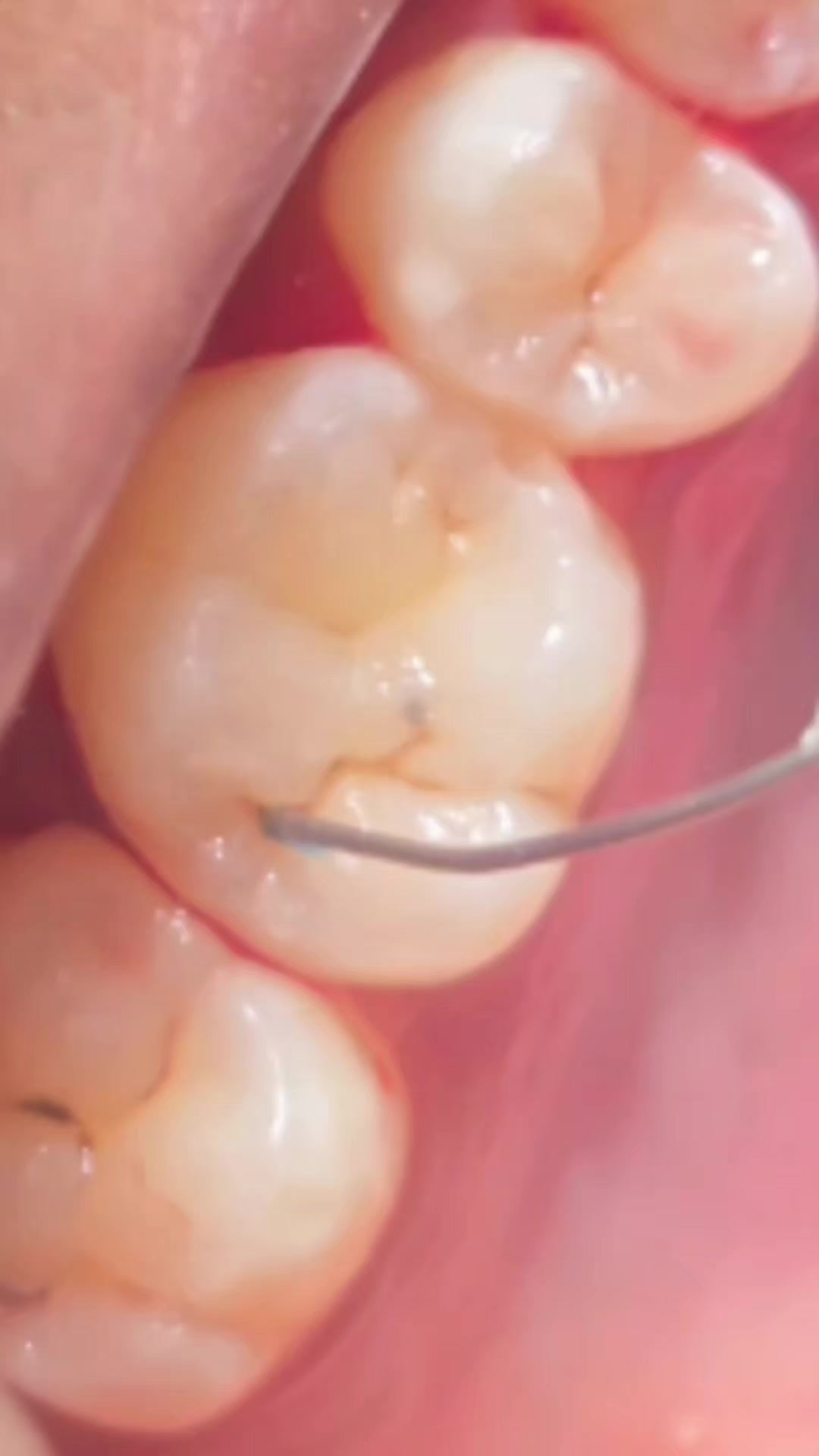 @Catford Dental