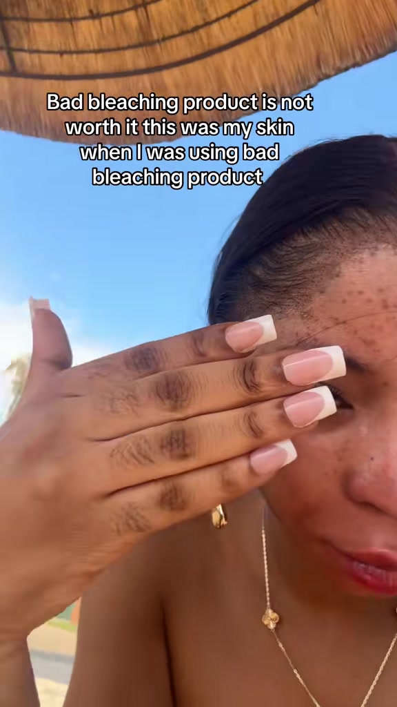 @Your skin solution🇳🇬🇬🇭🇬🇧