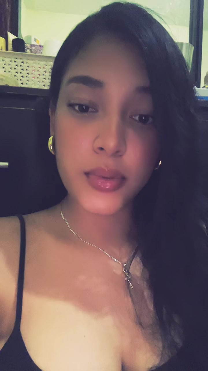 @Ana Esther🩷🩰