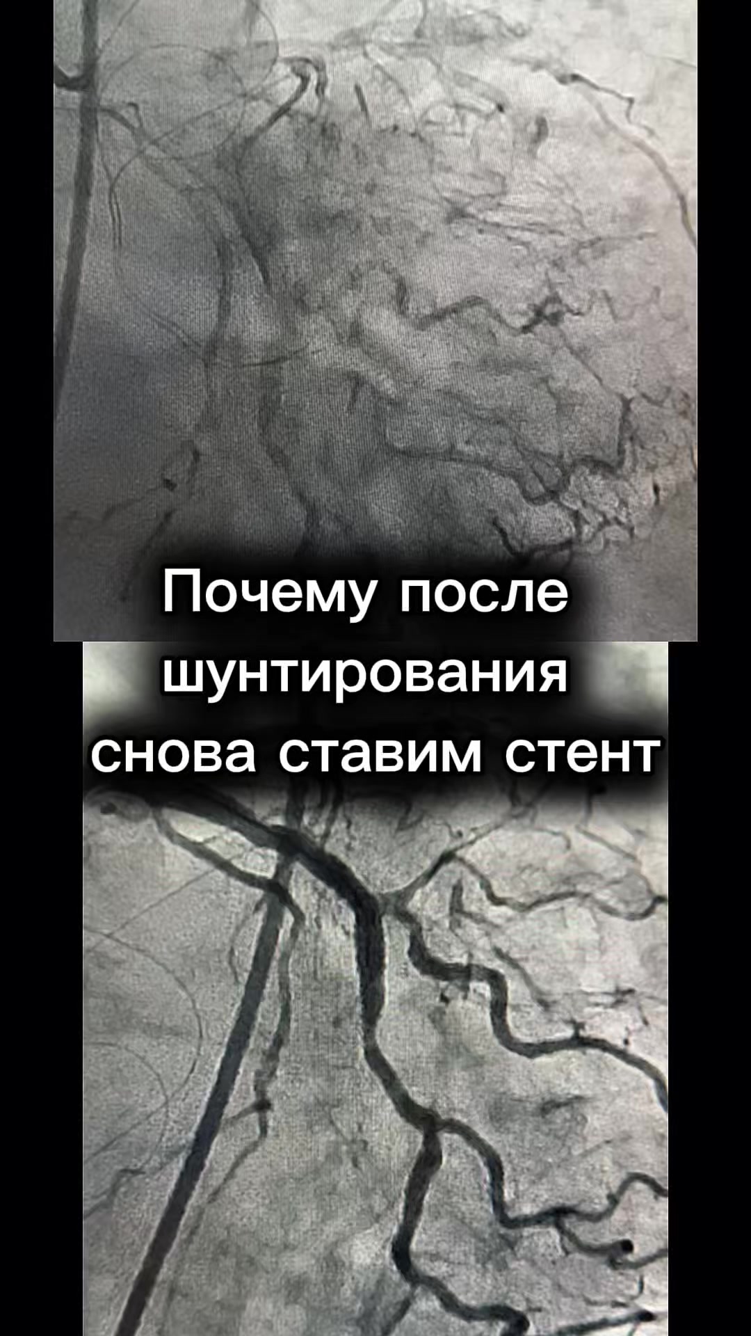 @Кардиолог / Аспет