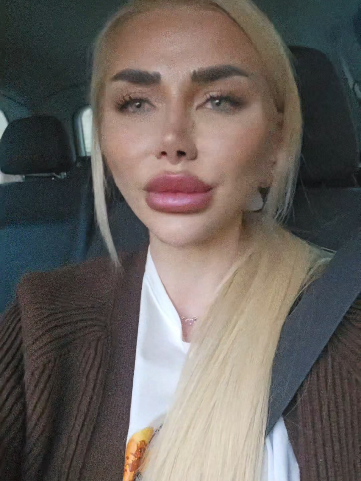 @𝐌𝐄𝐃𝐈 𝐇𝐑𝐈𝐒𝐓𝐎𝐕𝐀