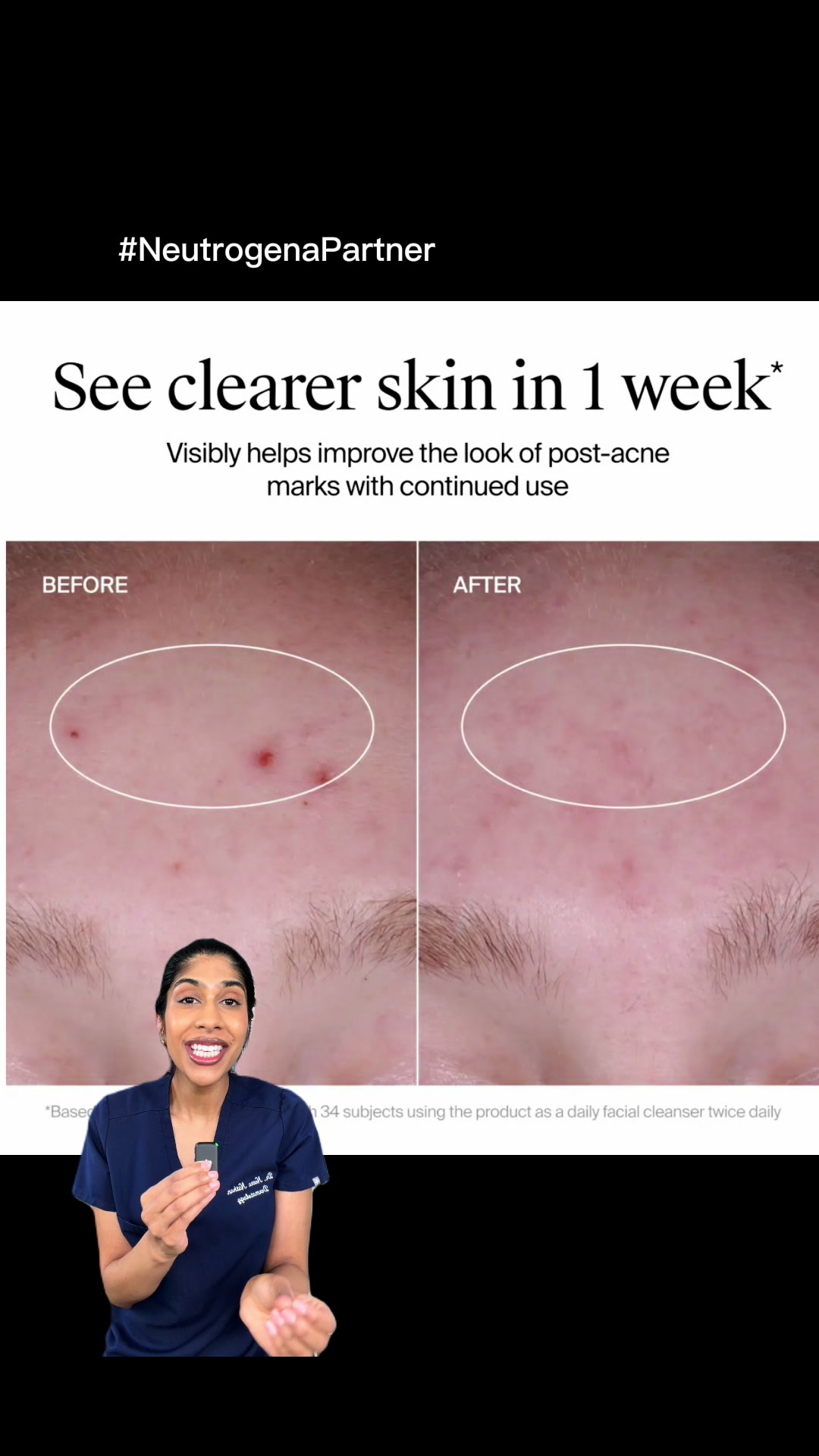 @Dr. Neera, Skin Surgeon
