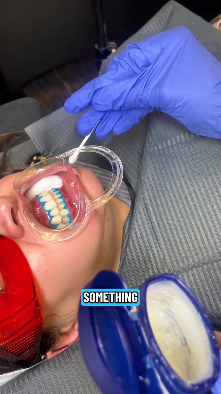 @Diandra | Teeth Whitening Tech