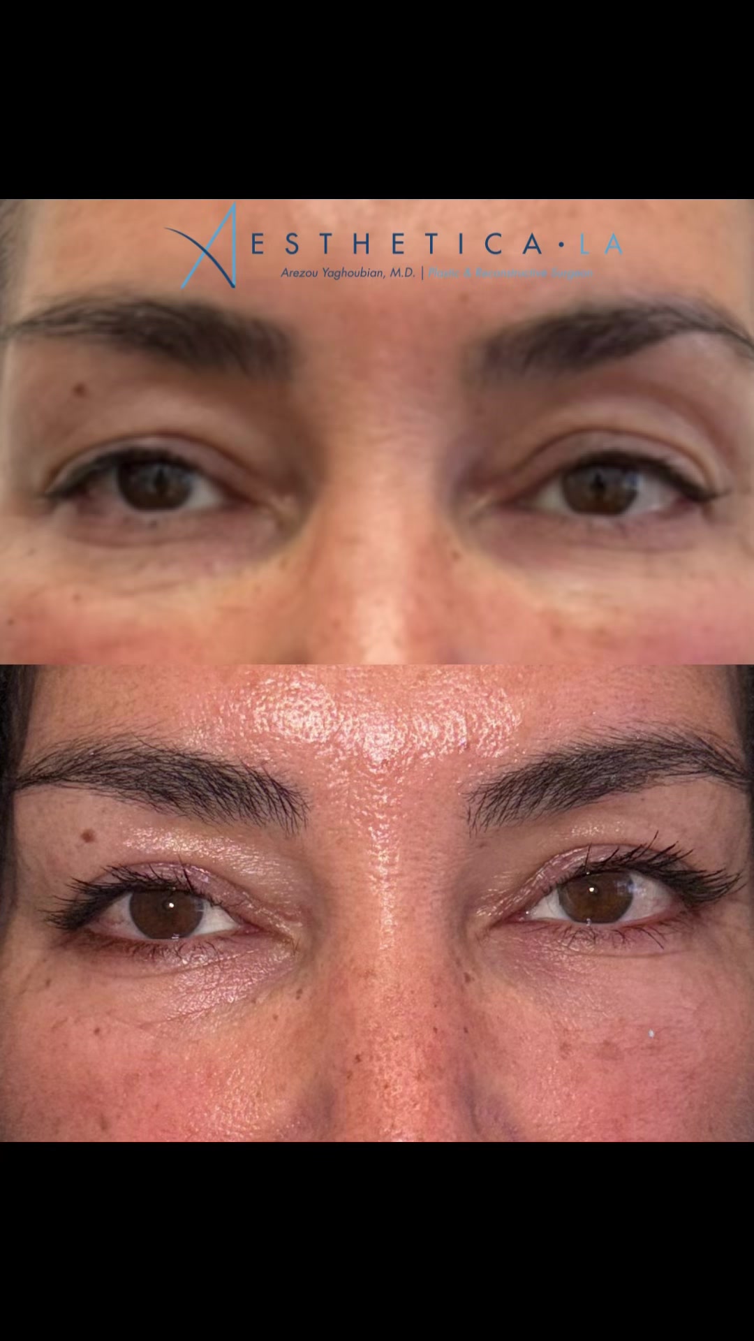 @AESTHETICA LA-Dr.Yaghoubian