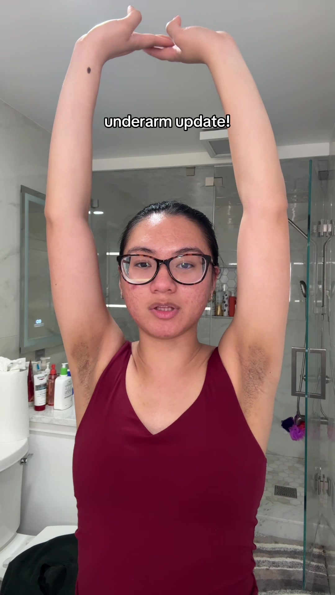 @jennilee &bull; thatacnegirlie
