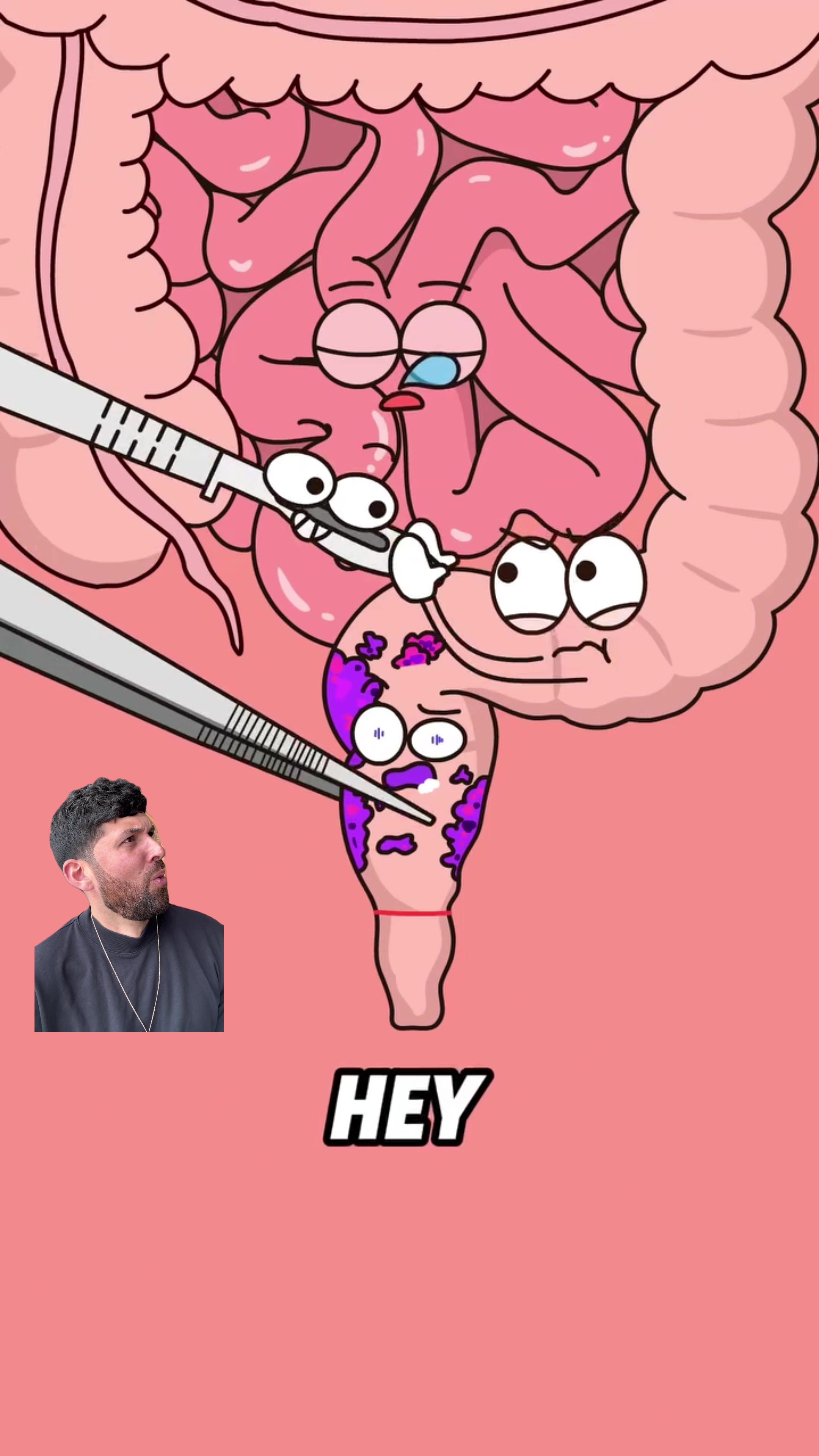 @Mr.Colitiscrohns