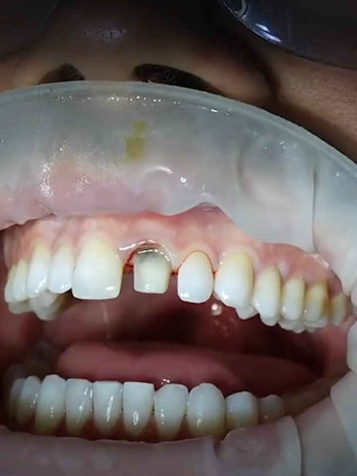 @BangkokSmileDentalClinic
