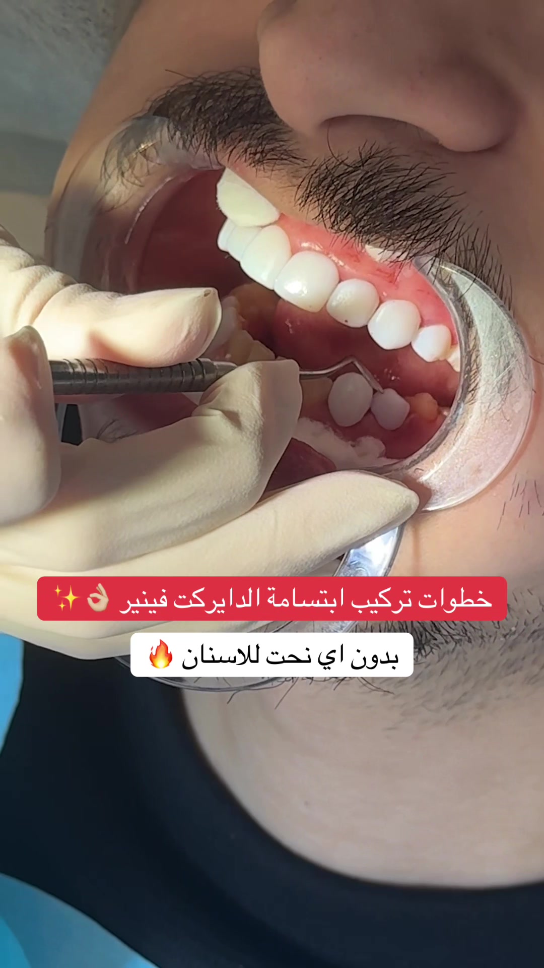 @Dr.lina_almasmoum