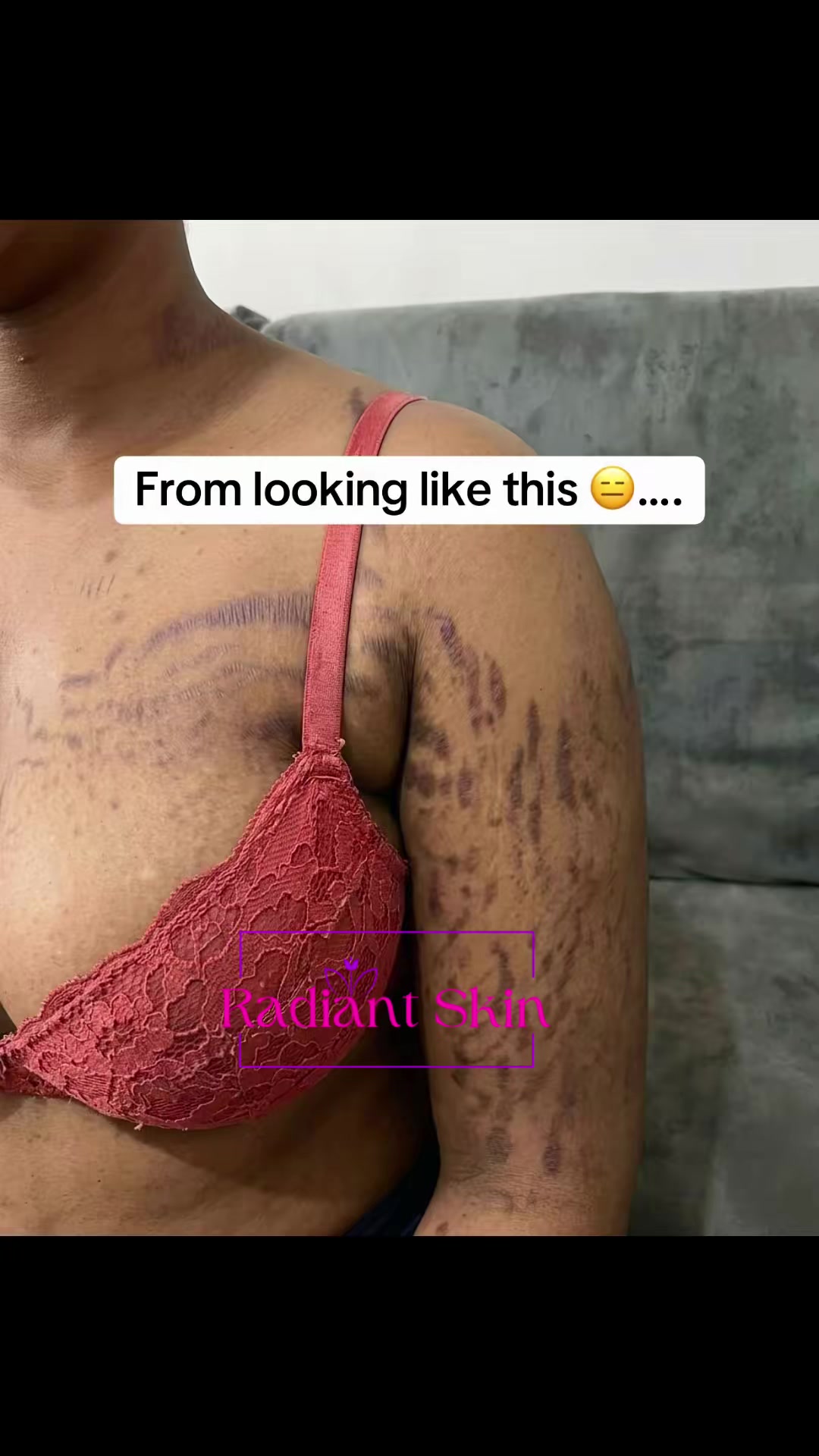 @Radiant skin
