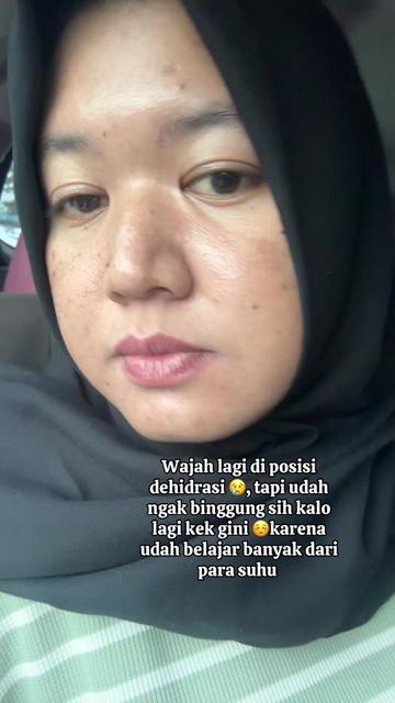 @ita_skinjourney