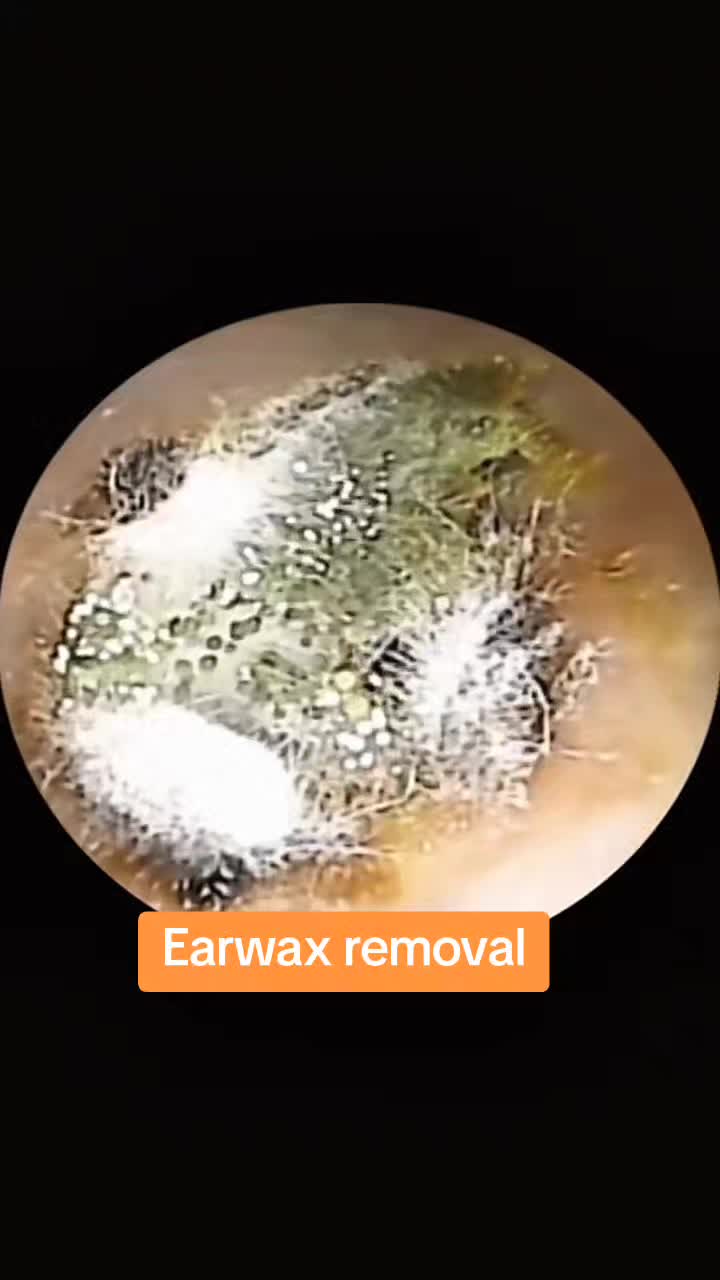 @Earwax.pro