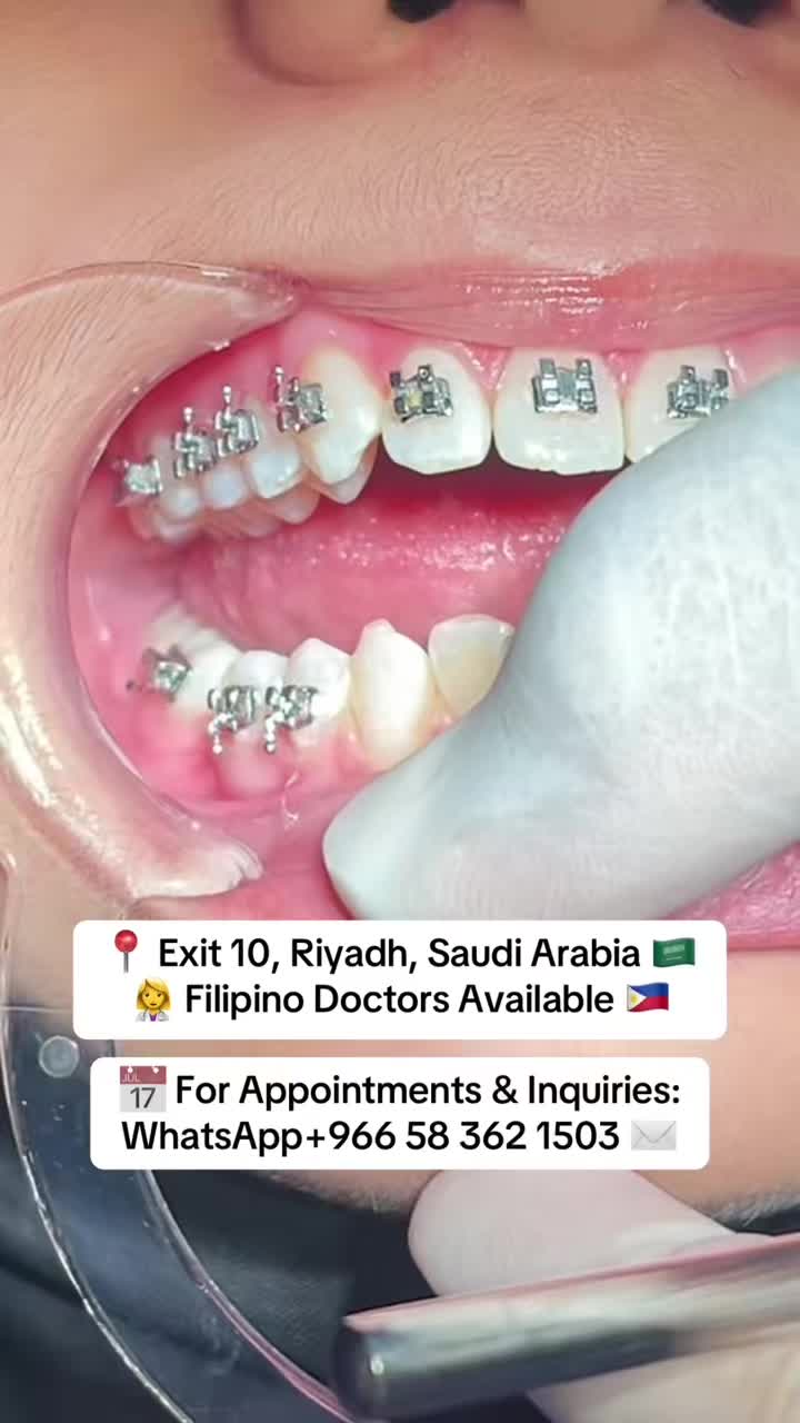 @DENTAL&DERMA CLINIC RIYADH🇸🇦