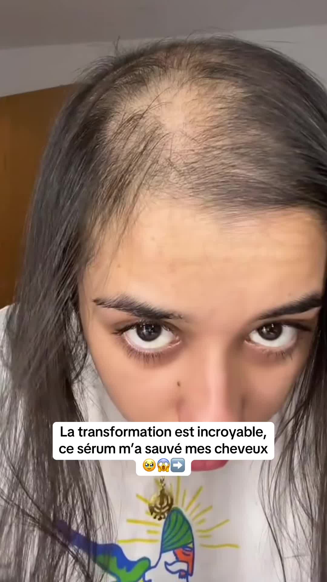 @Lux’Hair Growth FR