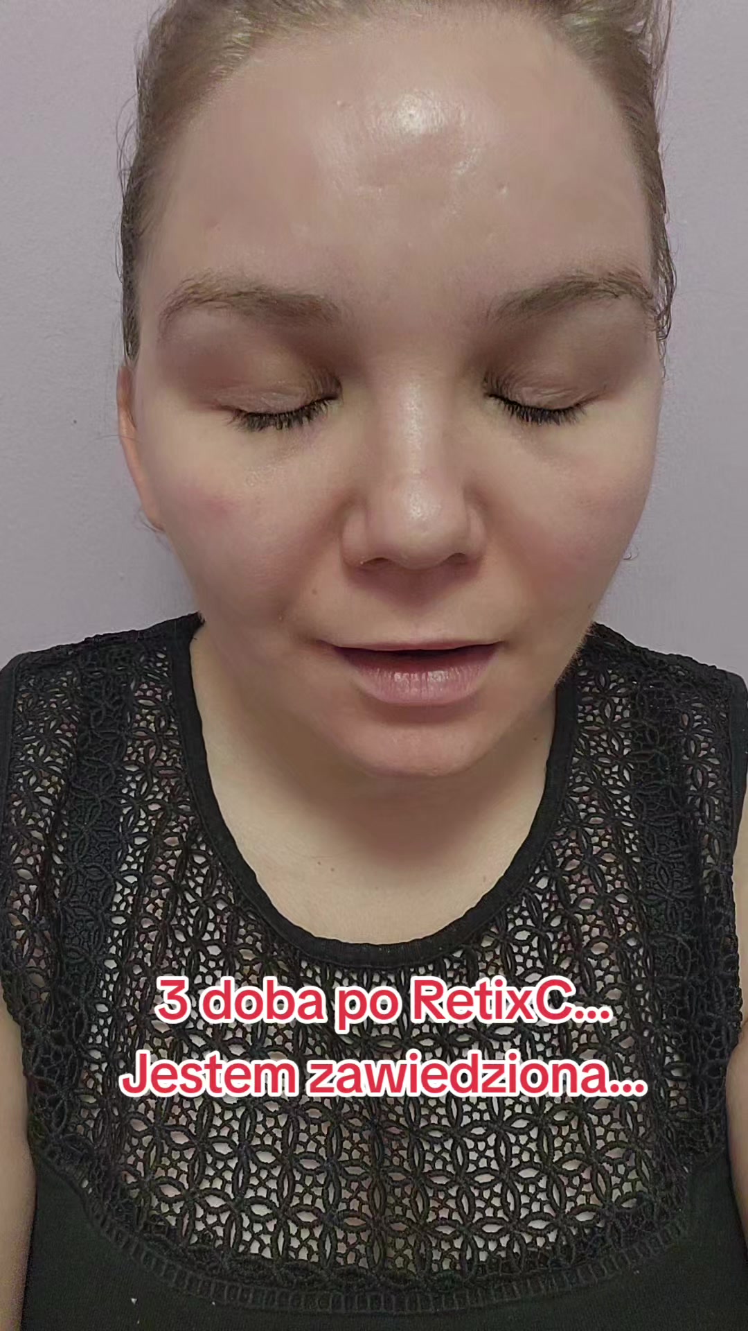 @👑🐍 Królowa Gadów 🐍👑