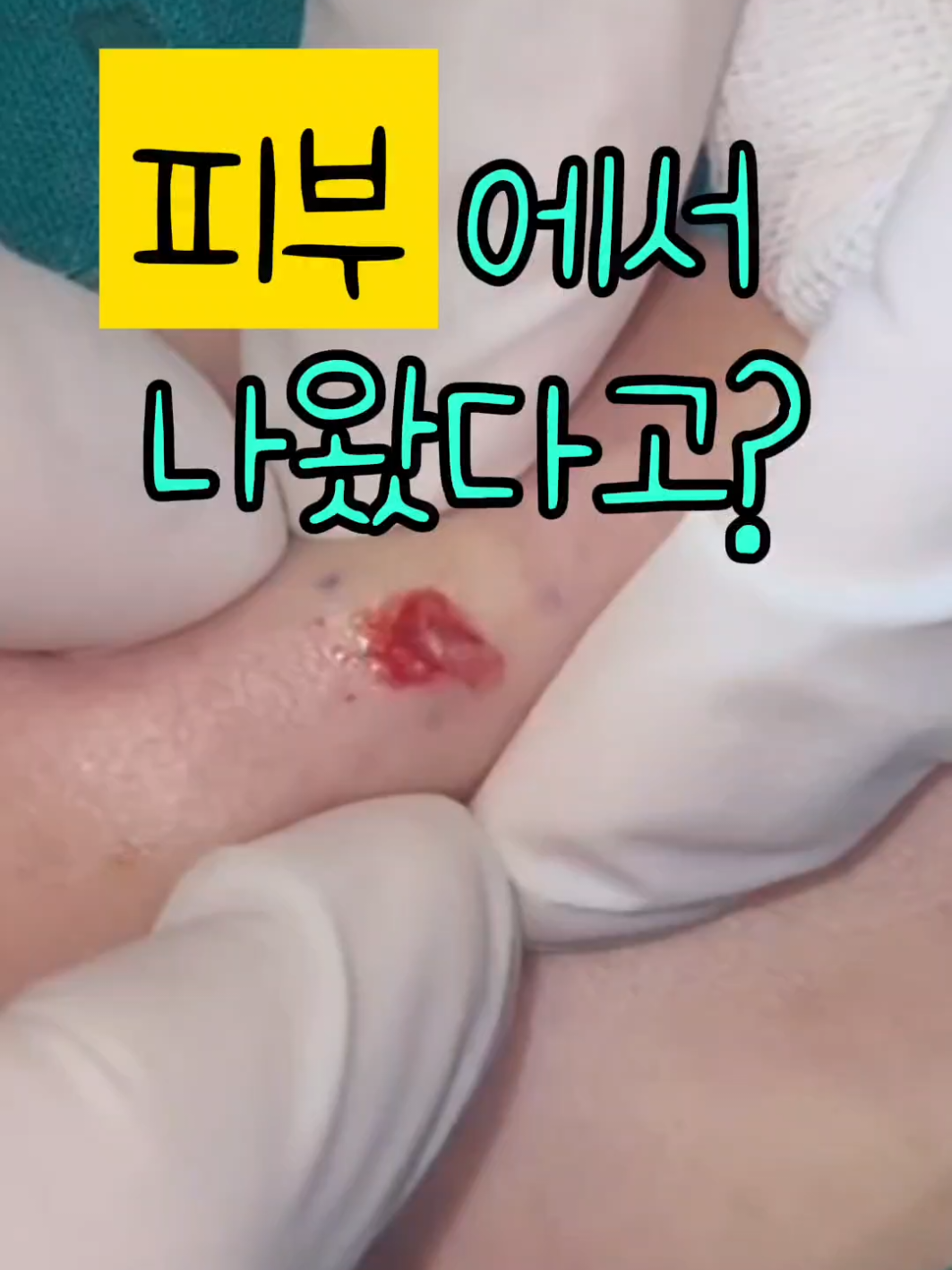 @아문성형외과