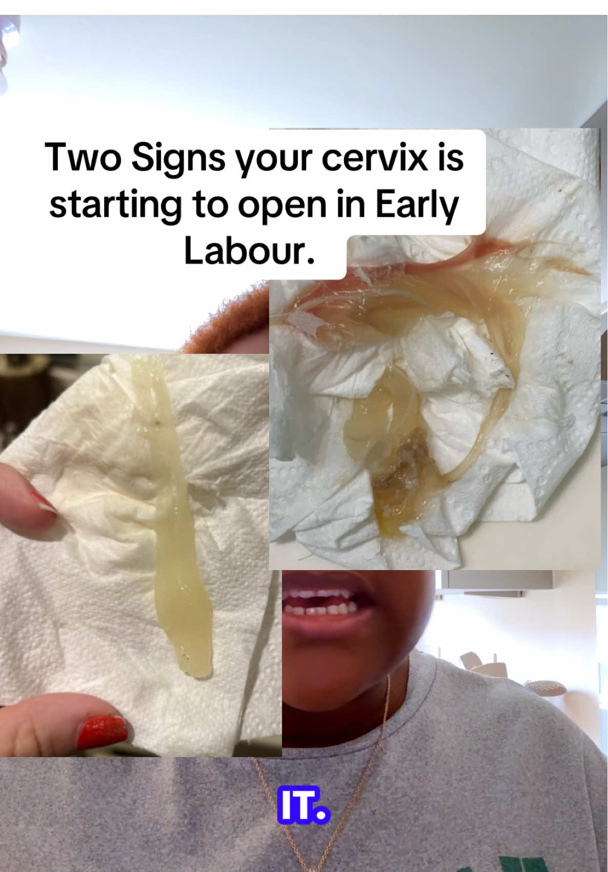 @D_Midwife🤰🏽👩🏽&zwj;🍼