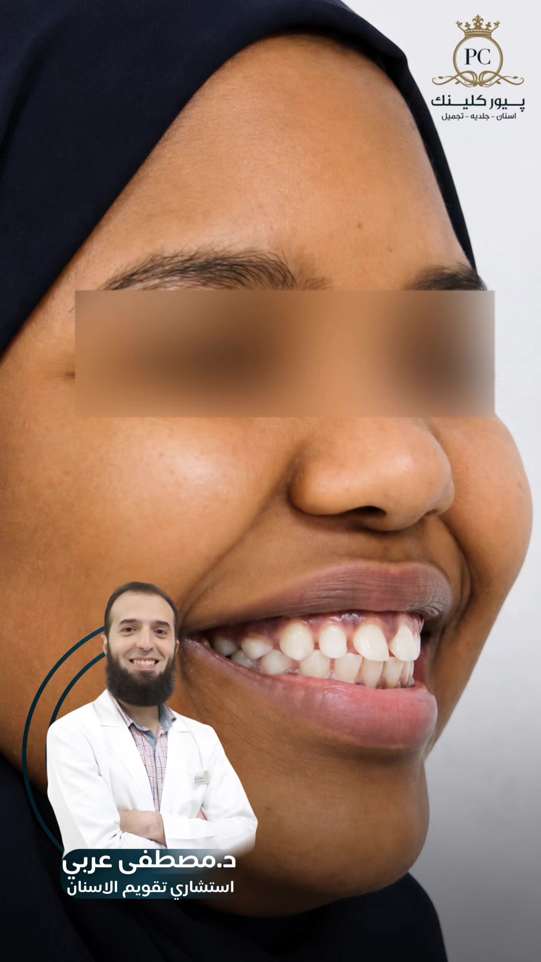 @عيادات بيور كلينك