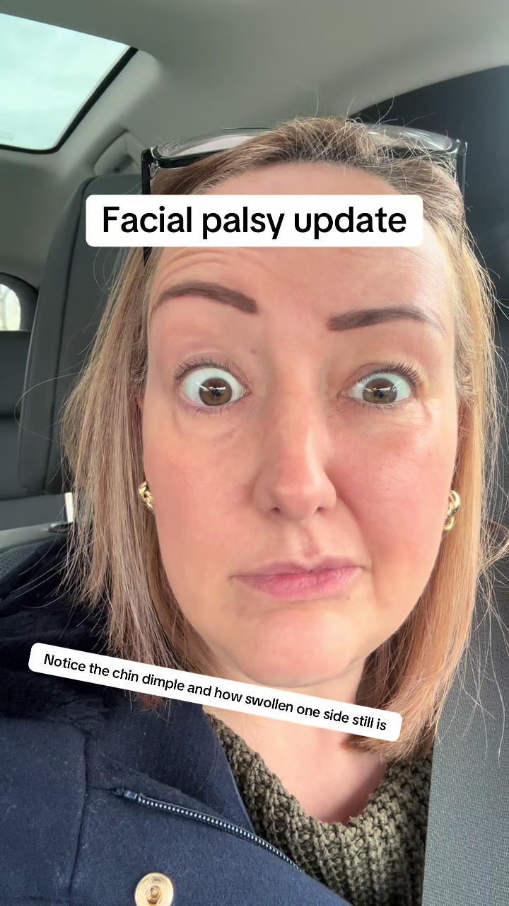 @cholesteatoma.chrissy