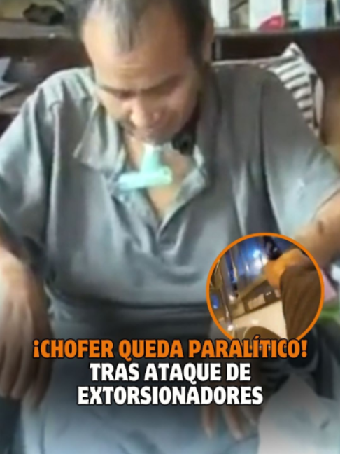 @Trome oficial