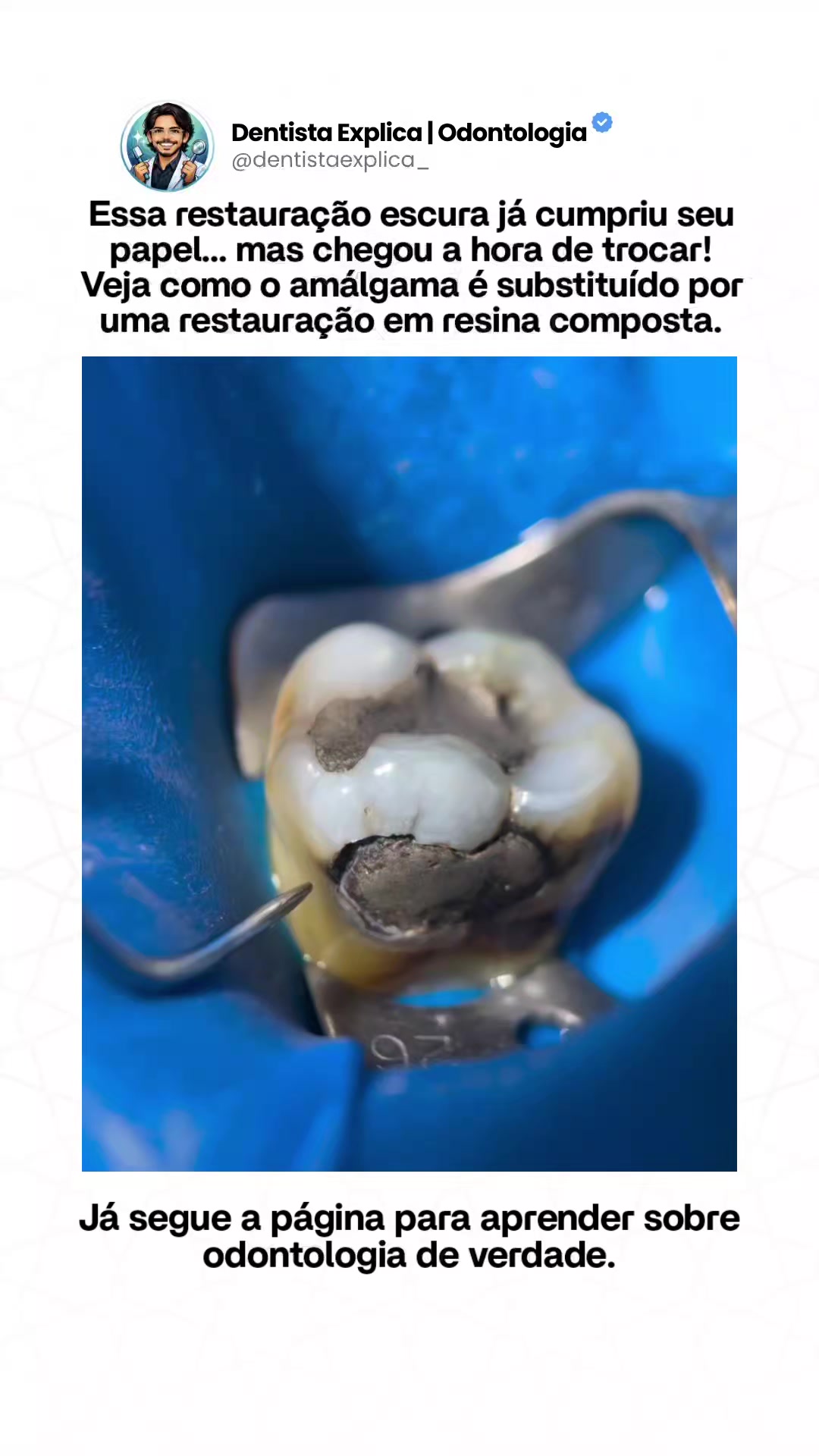 @Dentista Explica | Odontologia