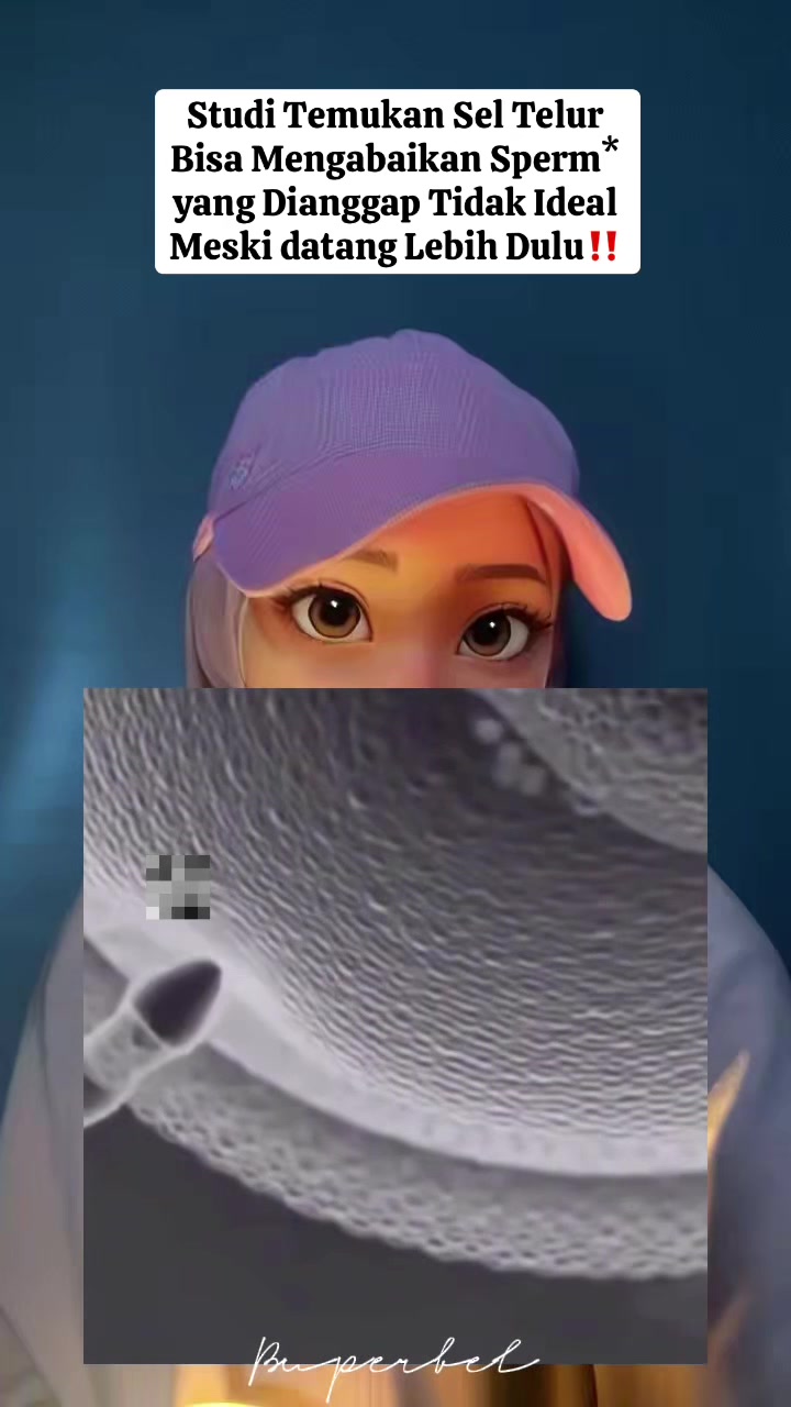 @B U P E R