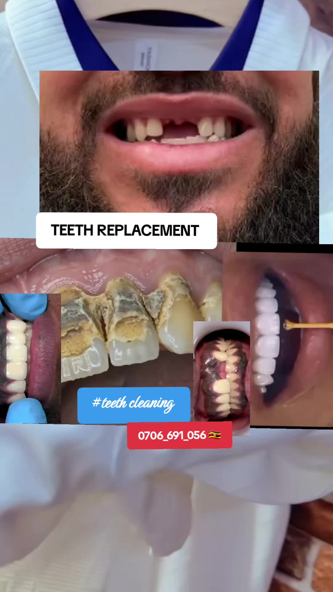 @Dental studio.🦷.Kampala