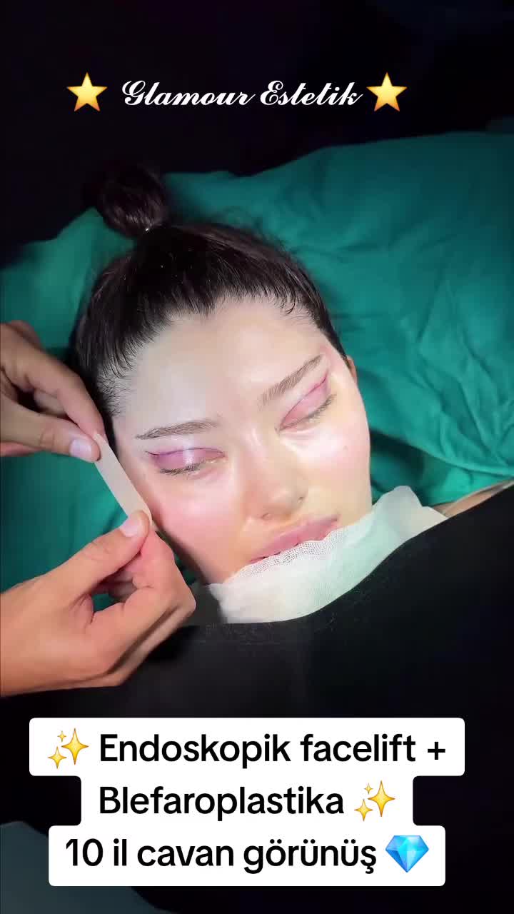 @Glamour Estetik Official