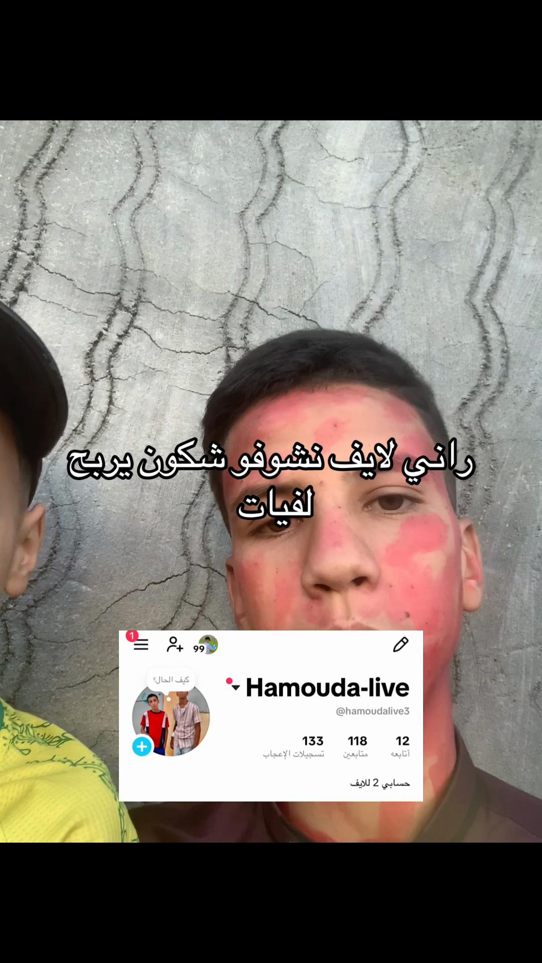 @Hamouda-34