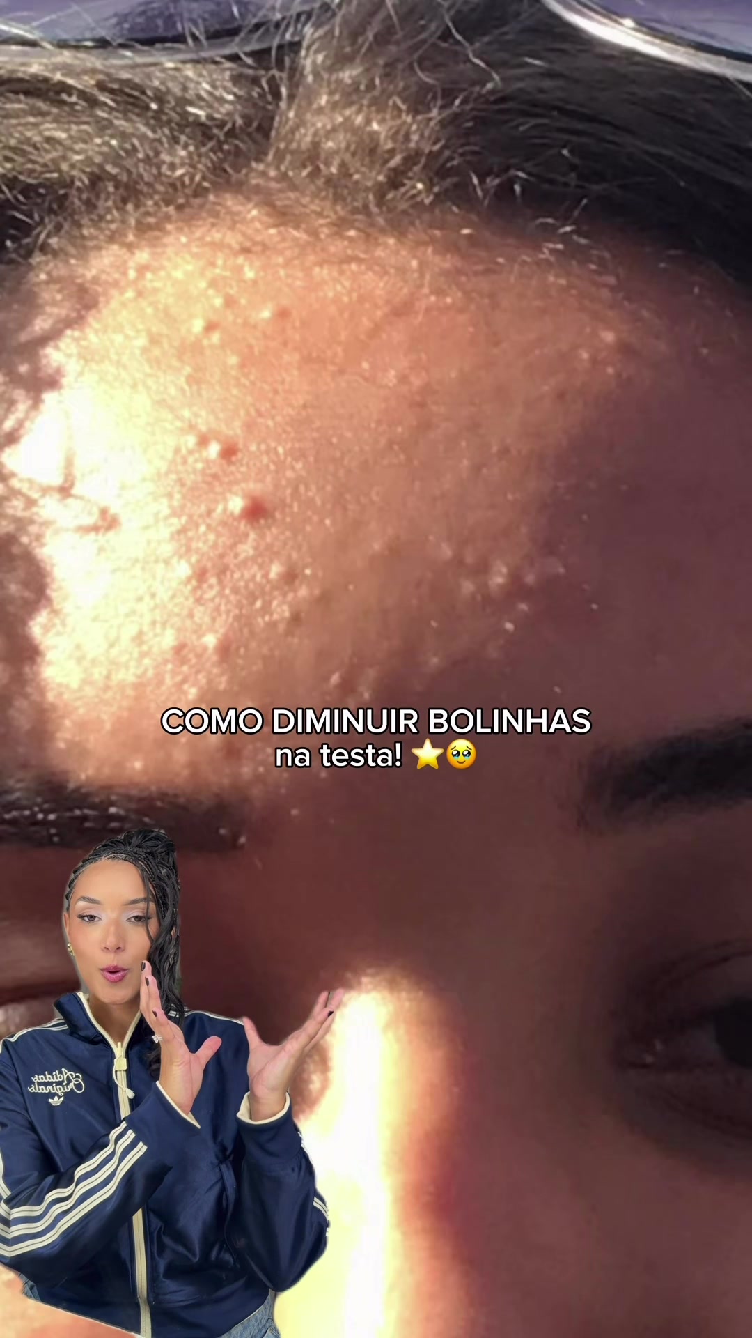 @Beatriz França