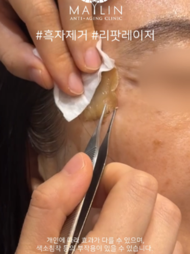 @메이린의원대구점