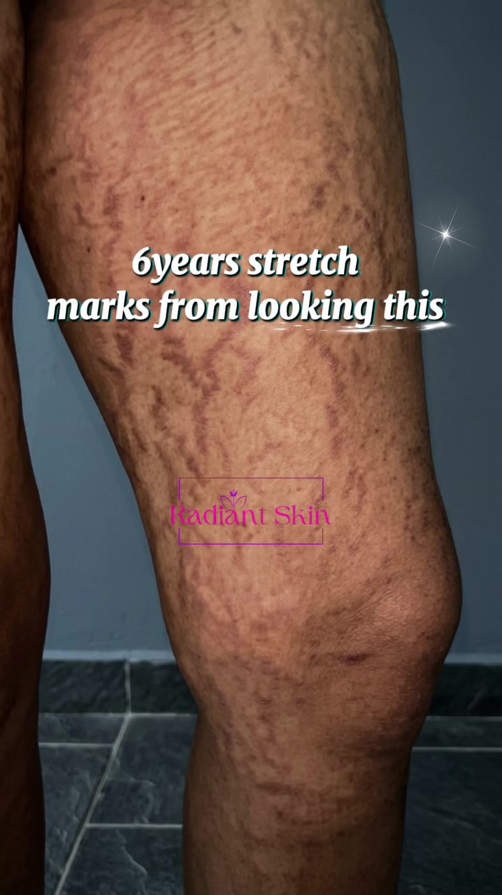@Radiant skin